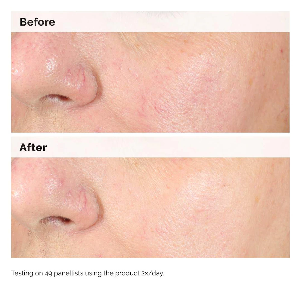 Day Dew Sunscreen Lightweight SPF 50 - Image 4